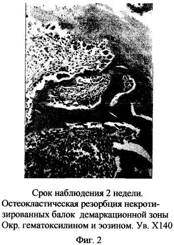 Способ создания модели сегментарного остеонекроза мыщелков, составляющих коленный сустав у животных (патент 2269824)