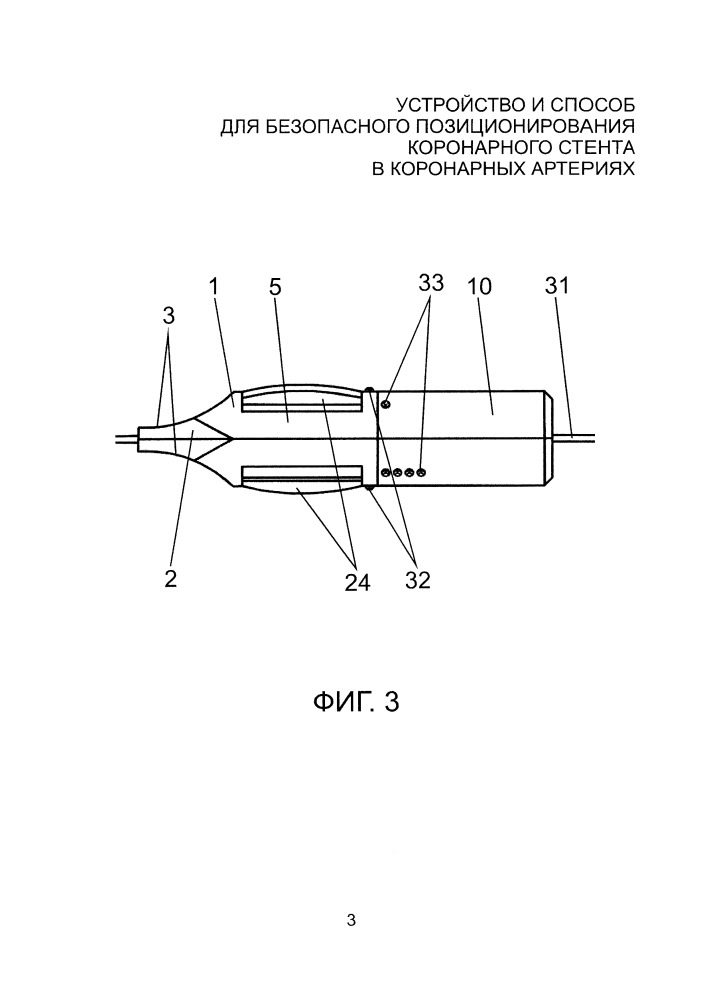 Устройство и способ для безопасного позиционирования коронарного стента в коронарных артериях (патент 2661092)