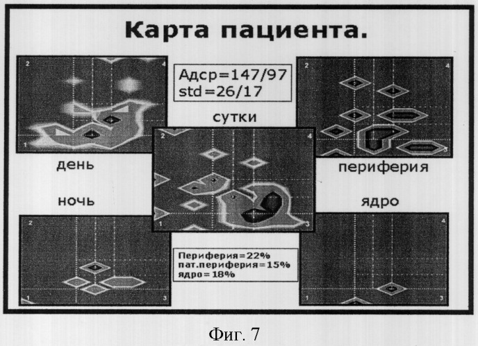 Способ графического отображения данных суточного мониторирования артериального давления, способ диагностического обследования больного аг, способ выбора тактики лечения больного аг и оценки эффективности лечения больного аг по вл. в. шкарину (патент 2301013)