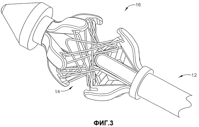 Винтовое управление отклонением для устройства наложения анастомотического кольца (патент 2426511)