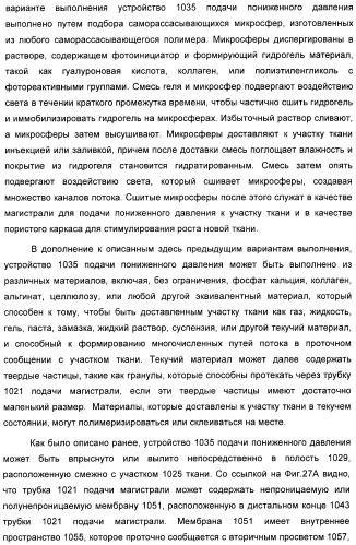 Устройство для лечения путем подкожной подачи пониженного давления с использованием разделения с помощью воздушного баллона (патент 2401652)