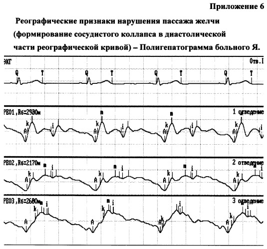 Способ и устройство для оценки гемодинамики печени (патент 2372022)