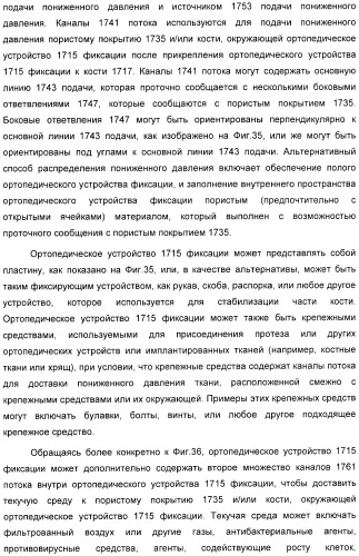 Система и способ продувки устройства пониженного давления во время лечения путем подачи пониженного давления (патент 2404822)