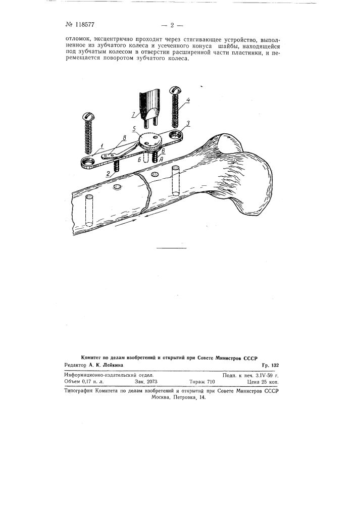 Металлический замок для сколачивания и экстрамедулярной фиксации отломков длинных трубчатых костей (патент 118577)