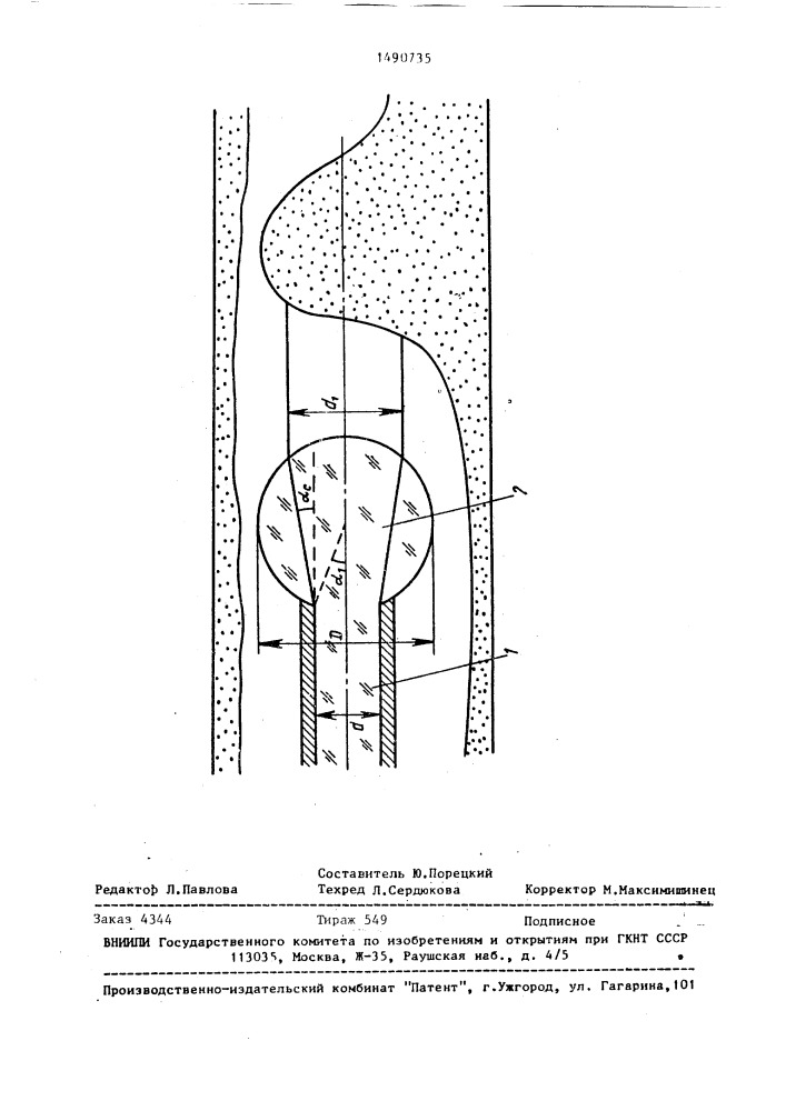 Устройство для лазерной ангиопластики (патент 1490735)