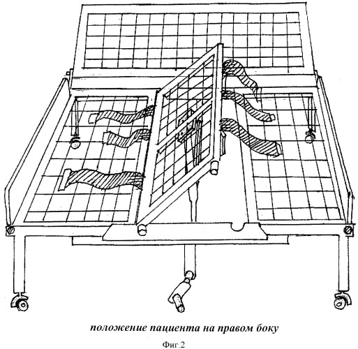 Функциональная кровать по уходу за больными (патент 2403002)