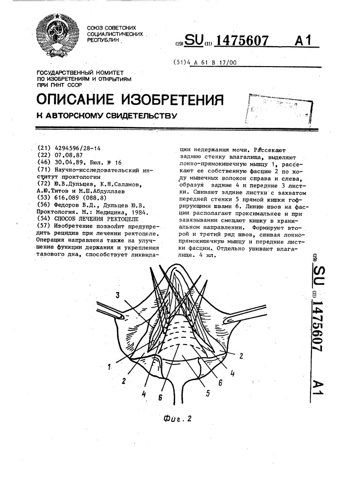 Способ лечения ректоцеле (патент 1475607)