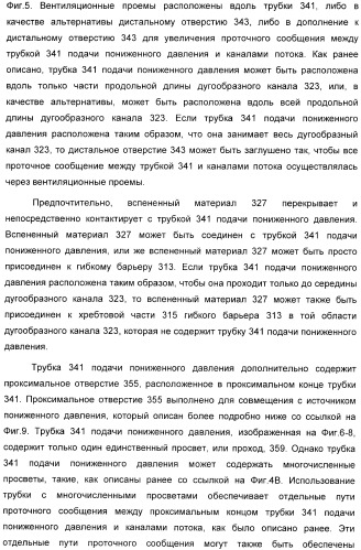 Устройство для лечения путем подкожной подачи пониженного давления с использованием разделения с помощью воздушного баллона (патент 2401652)