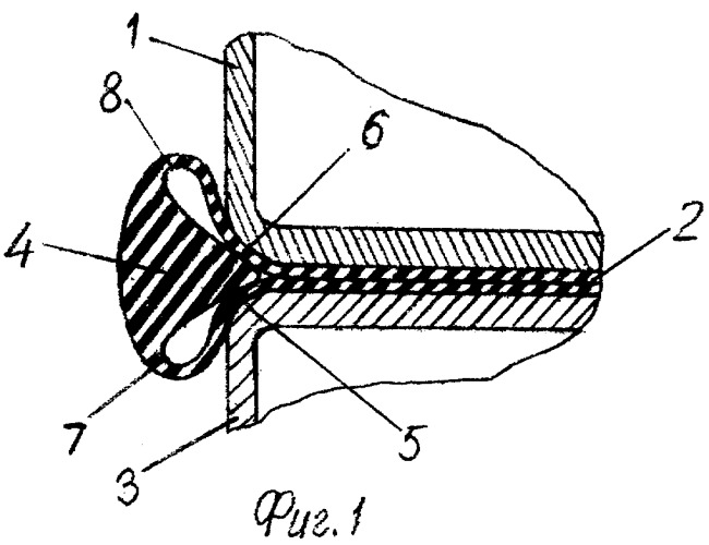 Перистальтический насос (патент 2290536)
