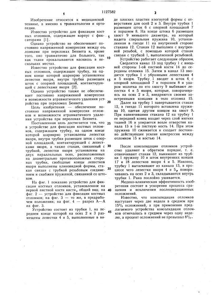 Устройство для фиксации костных отломков (патент 1127582)