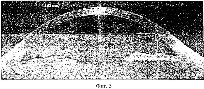 Способ измерения радиуса кривизны роговицы глаза (патент 2457774)