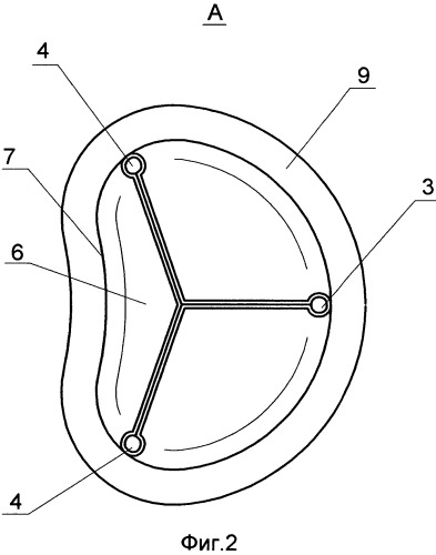 Протез митрального клапана сердца (патент 2541740)