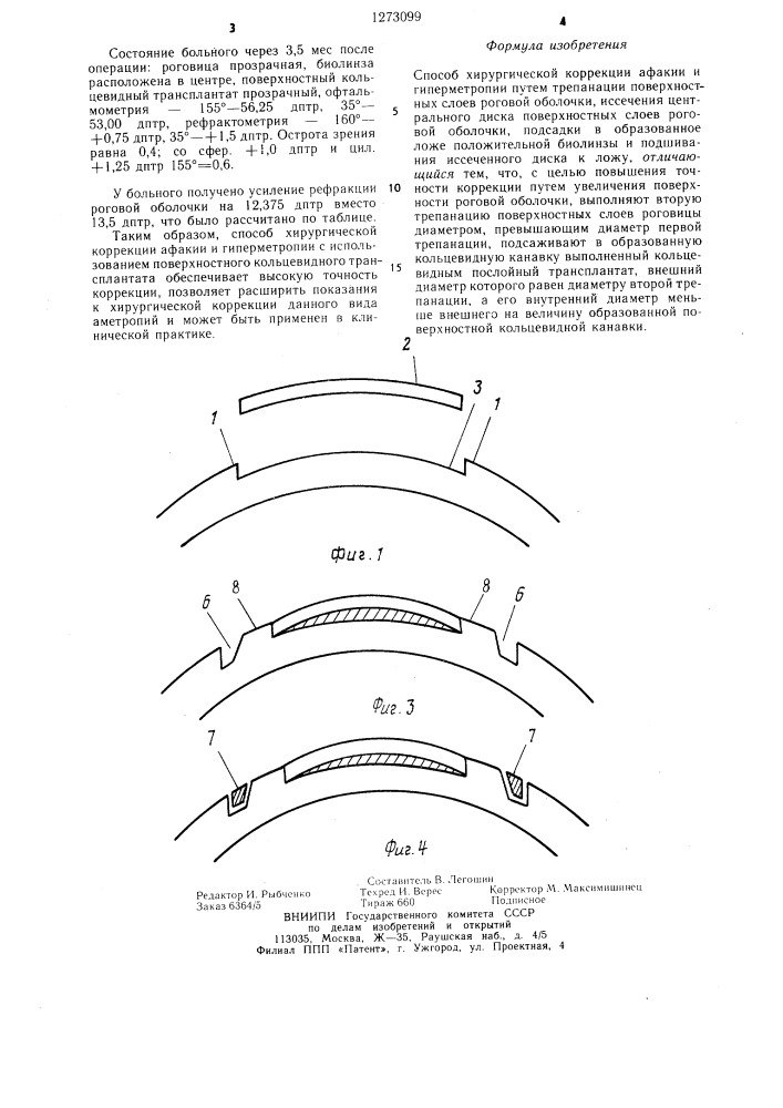 Способ хирургической коррекции афакии и гиперметропии (патент 1273099)