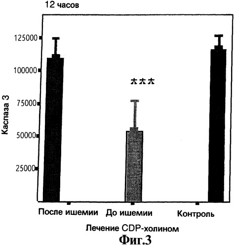 Cdp-холин - профилактическое средство для лечения церебральной ишемии и способ лечения с его использованием (патент 2255741)