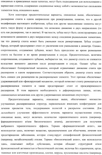 Баллонный расширяющийся стент, способный на восстановление расширения (патент 2388433)