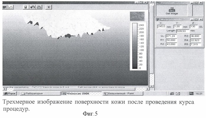 Способ коррекции инволюционных изменений кожи лица (патент 2379020)