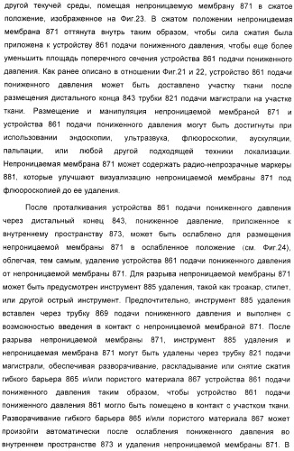 Система и способ продувки устройства пониженного давления во время лечения путем подачи пониженного давления (патент 2404822)