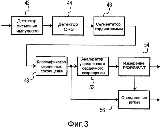 Мониторинг мерцательной аритмии (патент 2496413)