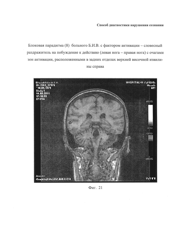 Способ диагностики нарушения сознания (патент 2596049)