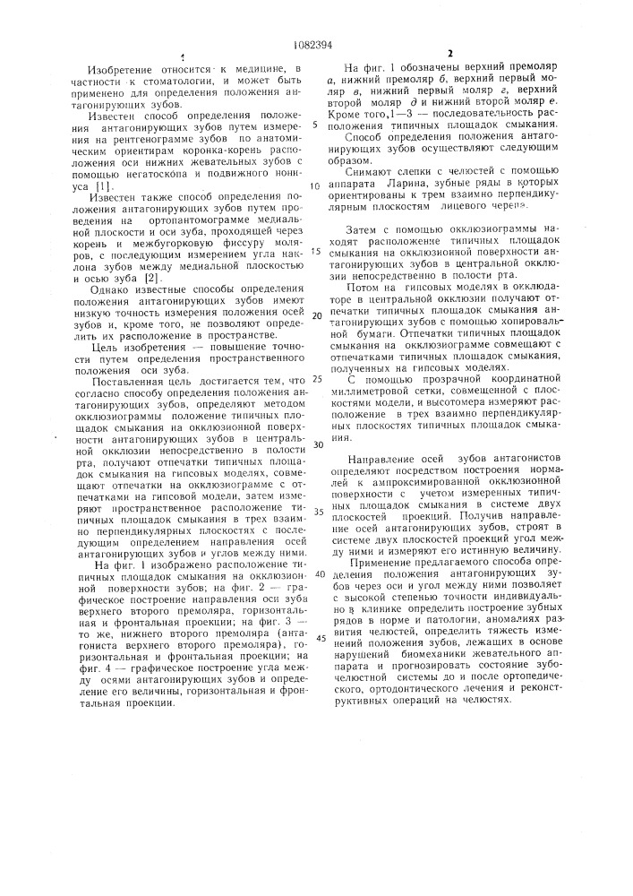 Способ определения положения антагонирующих зубов (патент 1082394)