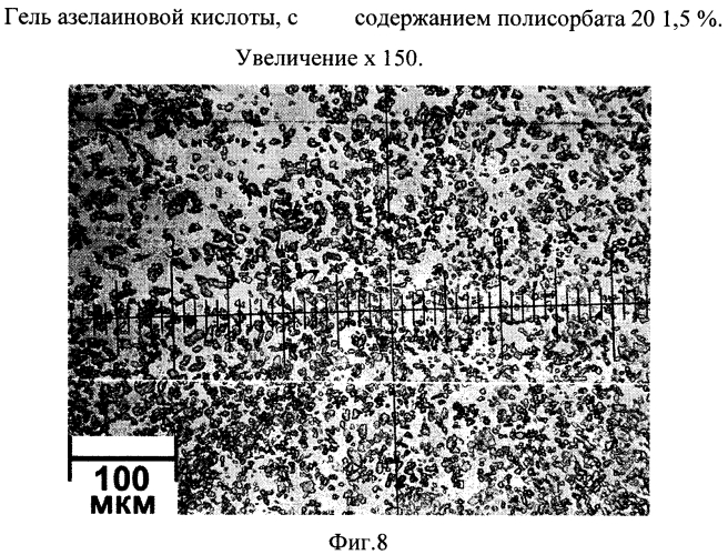 Стабильная гелевая форма азелаиновой кислоты (патент 2557932)