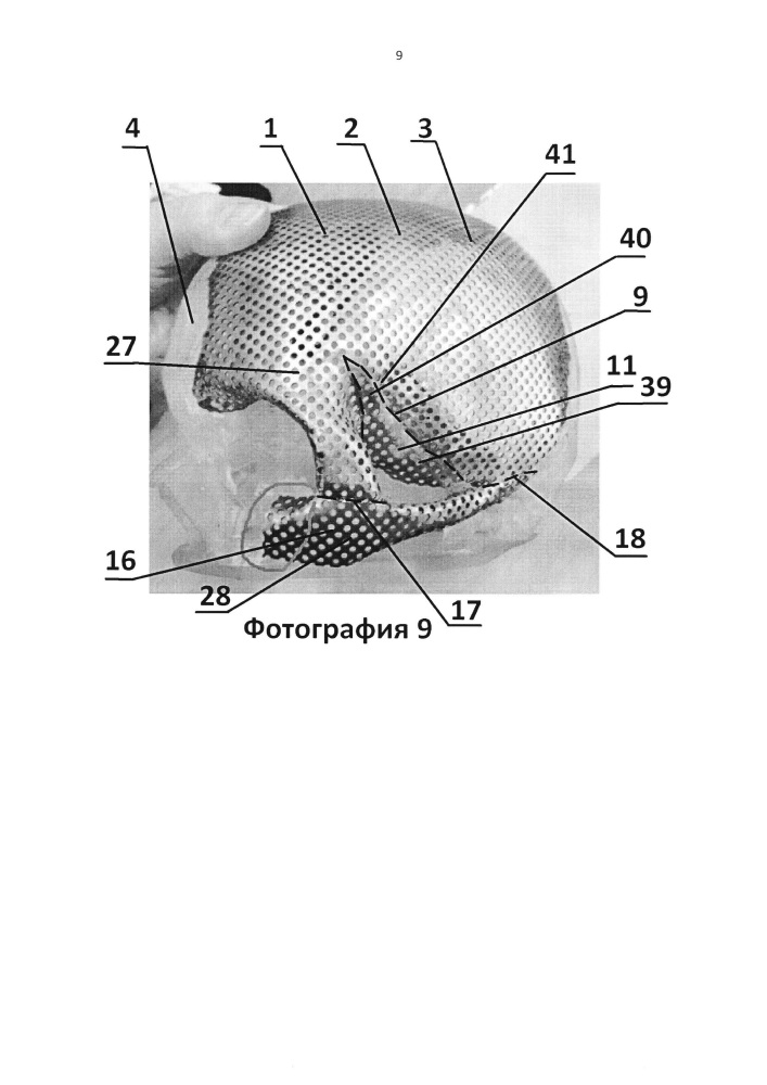 Имплантат для протезирования костей черепа и способ изготовления имплантата для протезирования костей черепа (патент 2638894)