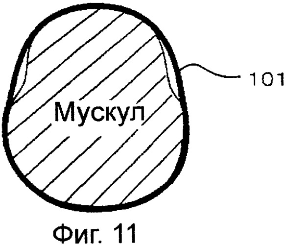 Устройство для укрепления мускулов (патент 2329846)