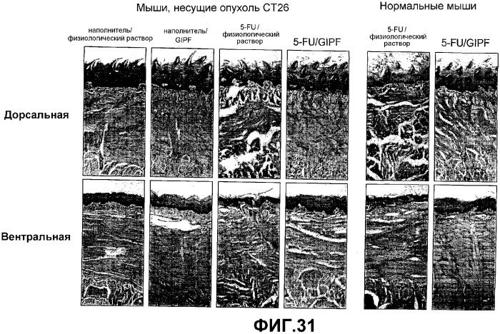 Желудочно-кишечный пролиферативный фактор и его применения (патент 2343158)