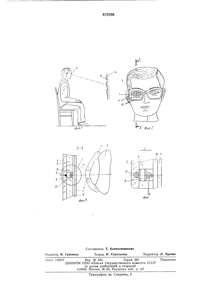 Устройство для определения направления взгляда (патент 670296)