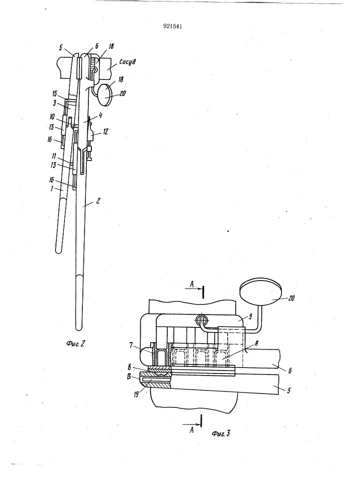 Аппарат для сшивания кровеносных сосудов (патент 921541)