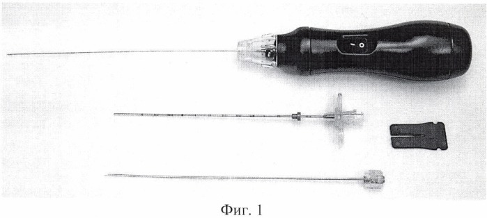 Способ пункционной чрескожной микродискэктомии на уровне l5-s1 механическим декомпрессором (патент 2458645)