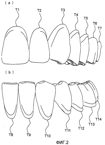 Искусственные зубы, позволяющие легко достигнуть двухсторонней сбалансированной окклюзии (патент 2456956)