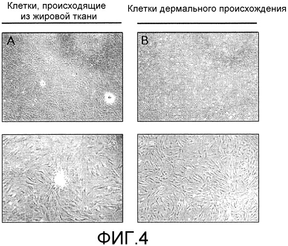 Композиция филлера для мягких тканей для инъекции и способ ее получения (патент 2396084)