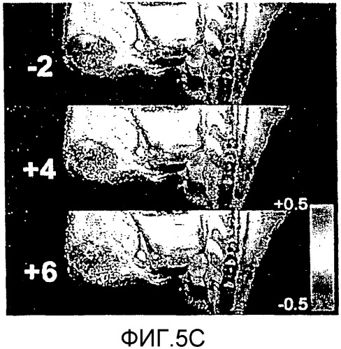 Сенсибилизированный оперативный bold-mri способ получения изображения (патент 2343829)