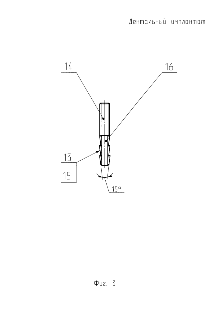 Дентальный имплантат (патент 2624173)