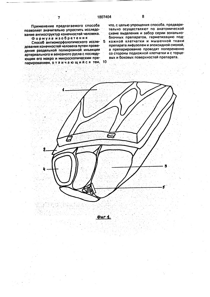Способ ангиоморфологического исследования конечностей человека (патент 1807404)