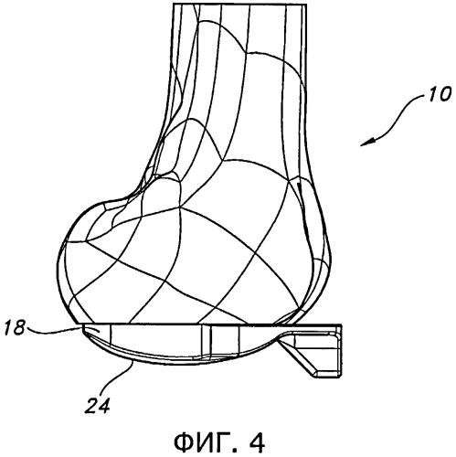 Способы и устройства для артропластики коленного сустава (патент 2583369)