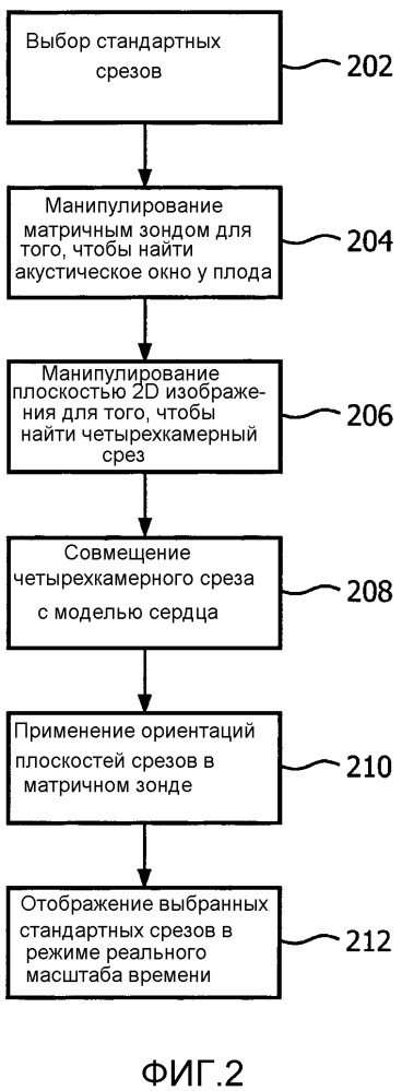 Автоматическое позиционирование стандартных плоскостей для оценки сердца плода в режиме реального времени (патент 2654611)