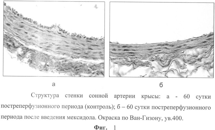 Способ коррекции структурных перестроек сосудов в эксперименте (патент 2349320)