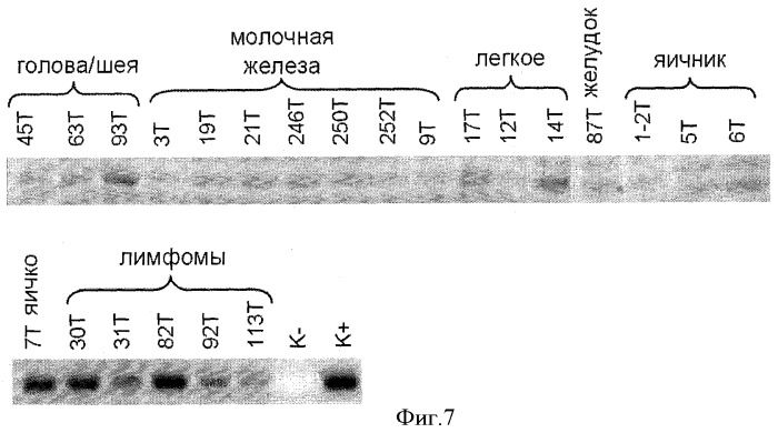 Способ диагностики онкологических заболеваний (патент 2384845)