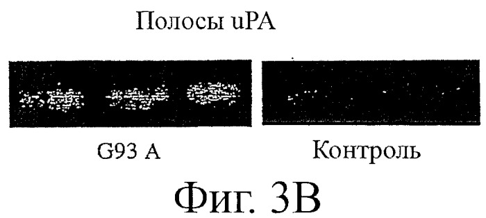 Применение ингибиторов урокиназы для лечения и/или предупреждения невропатологических заболеваний (патент 2410087)