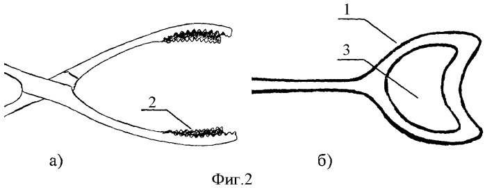 Устройство для репозиции и удержания костных отломков (патент 2410054)