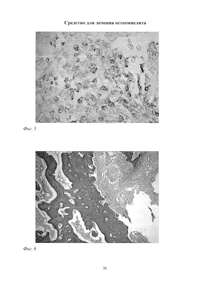 Средство для лечения остеомиелита (патент 2604124)