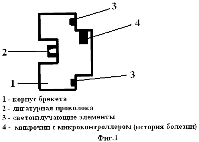 Брекет светодиодный для ортодонтического лечения (патент 2452428)
