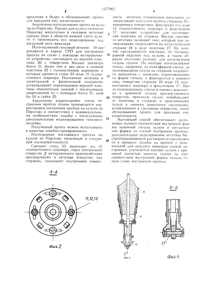 Способ изготовления протеза (патент 1277961)