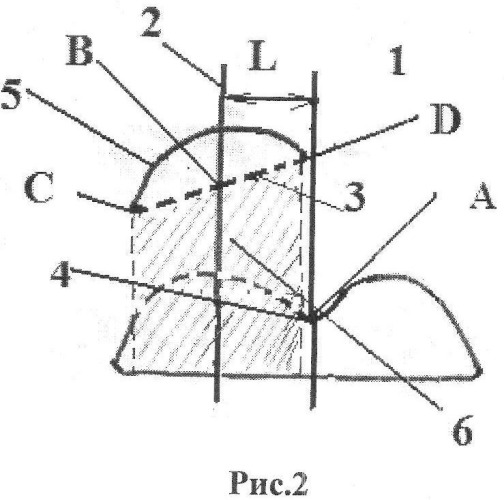 Способ ультразвукового определения величины латеральной дислокации надколенника (патент 2533837)