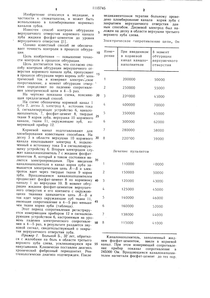 Способ контроля обтурации верхушечного отверстия корневого канала зуба (патент 1115745)