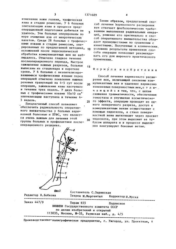 Способ лечения варикозного расширения вен (патент 1371689)