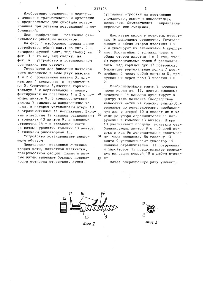 Устройство для фиксации позвоночника (патент 1237195)