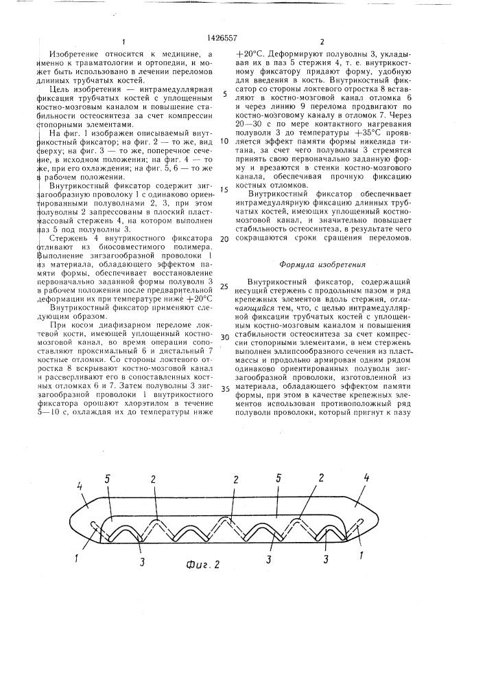Внутрикостный фиксатор (патент 1426557)